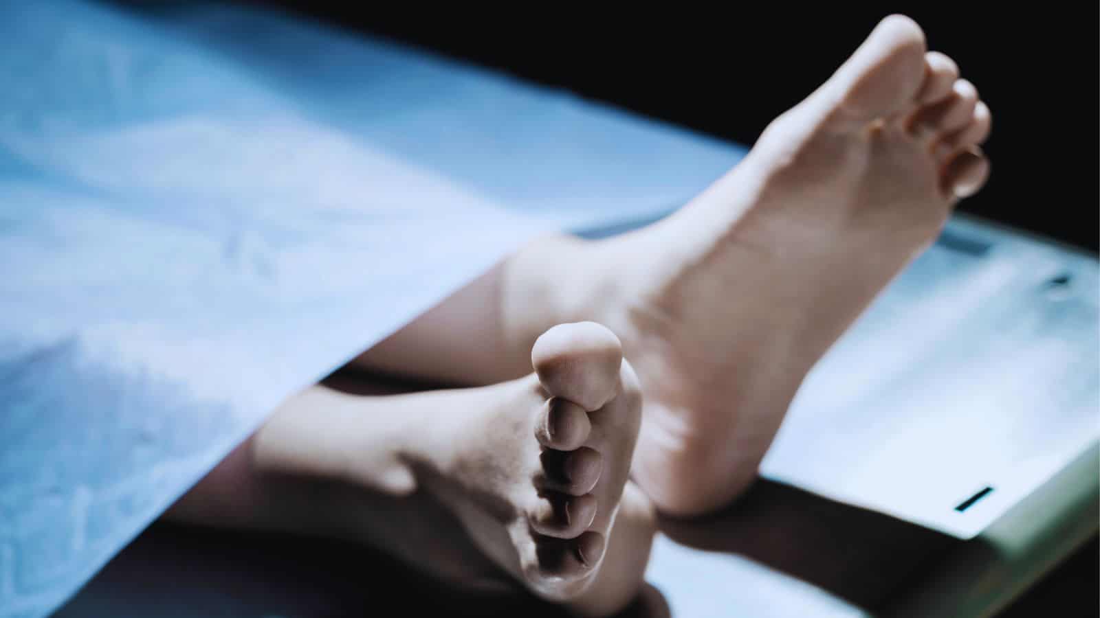 Image shows the lifeless body of a young boy on a hospital bed, related to a murder case