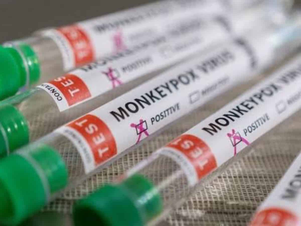 Jordan detects first monkeypox case
