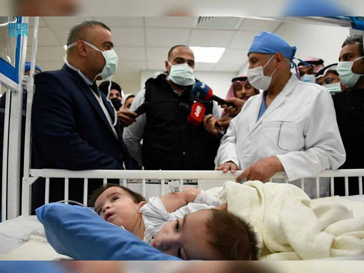 Saudi Hr Surgery To Separate Conjoined Iraqi Twins Begins
