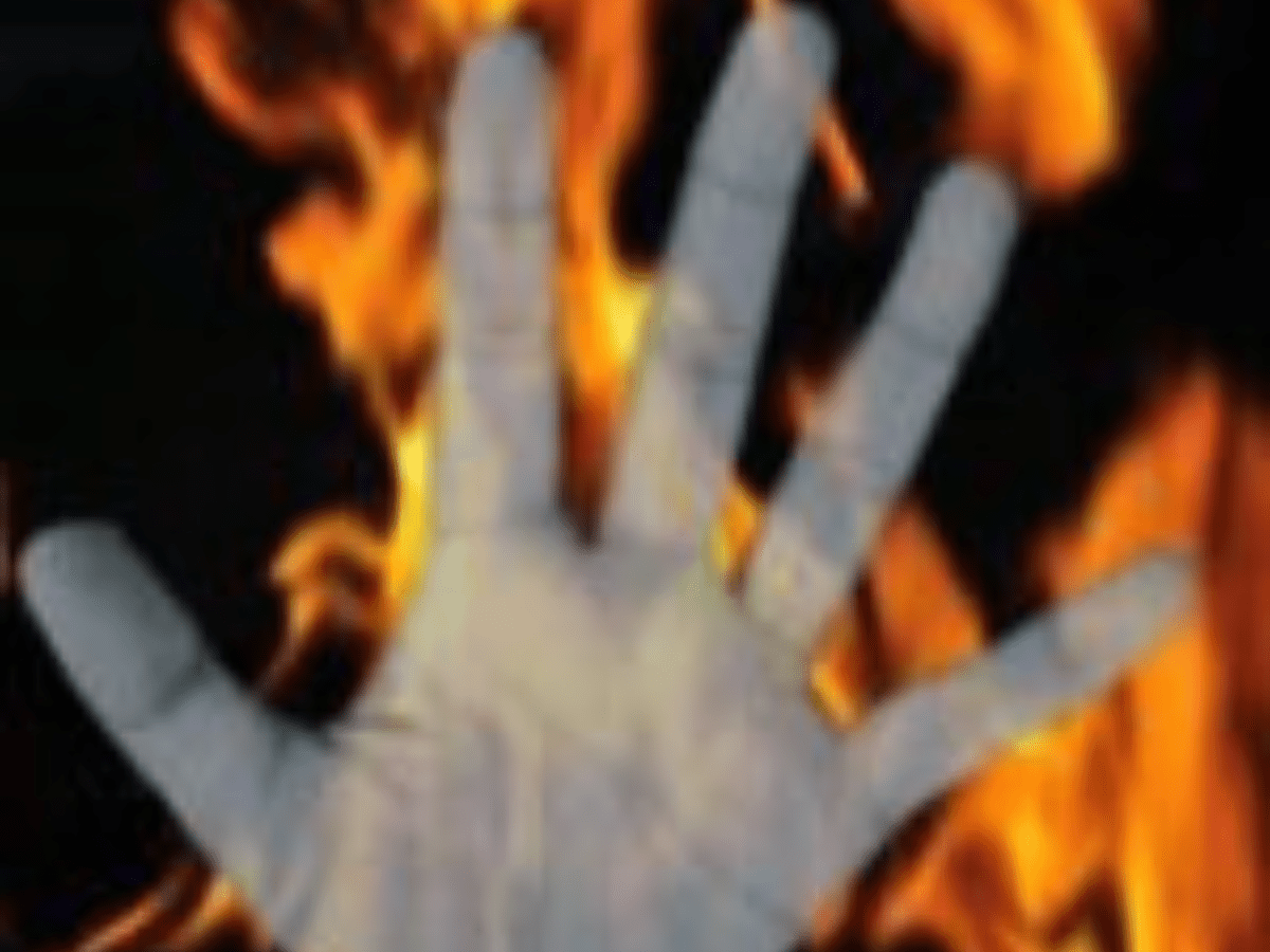 Newly-married woman found with burn injuries on highway in UP
