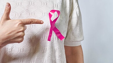 AI outperforms standard risk model for predicting breast cancer: Study