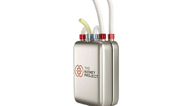 New artificial kidney-like device to free patients from dialysis