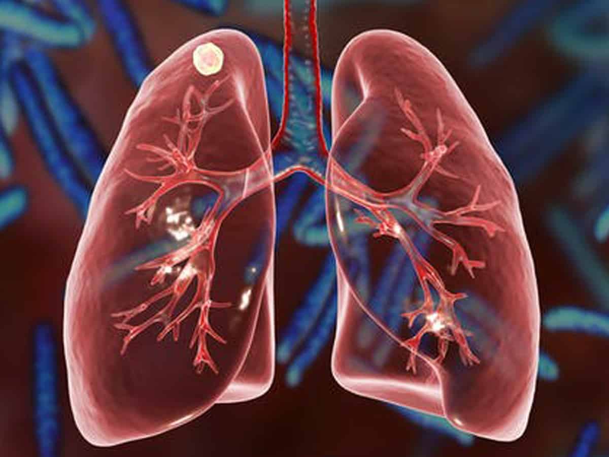 Exercise, yoga can boost lung function in adults with asthma