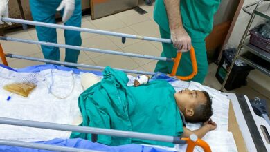 Over 10 children lose legs every day in Gaza since Oct 7