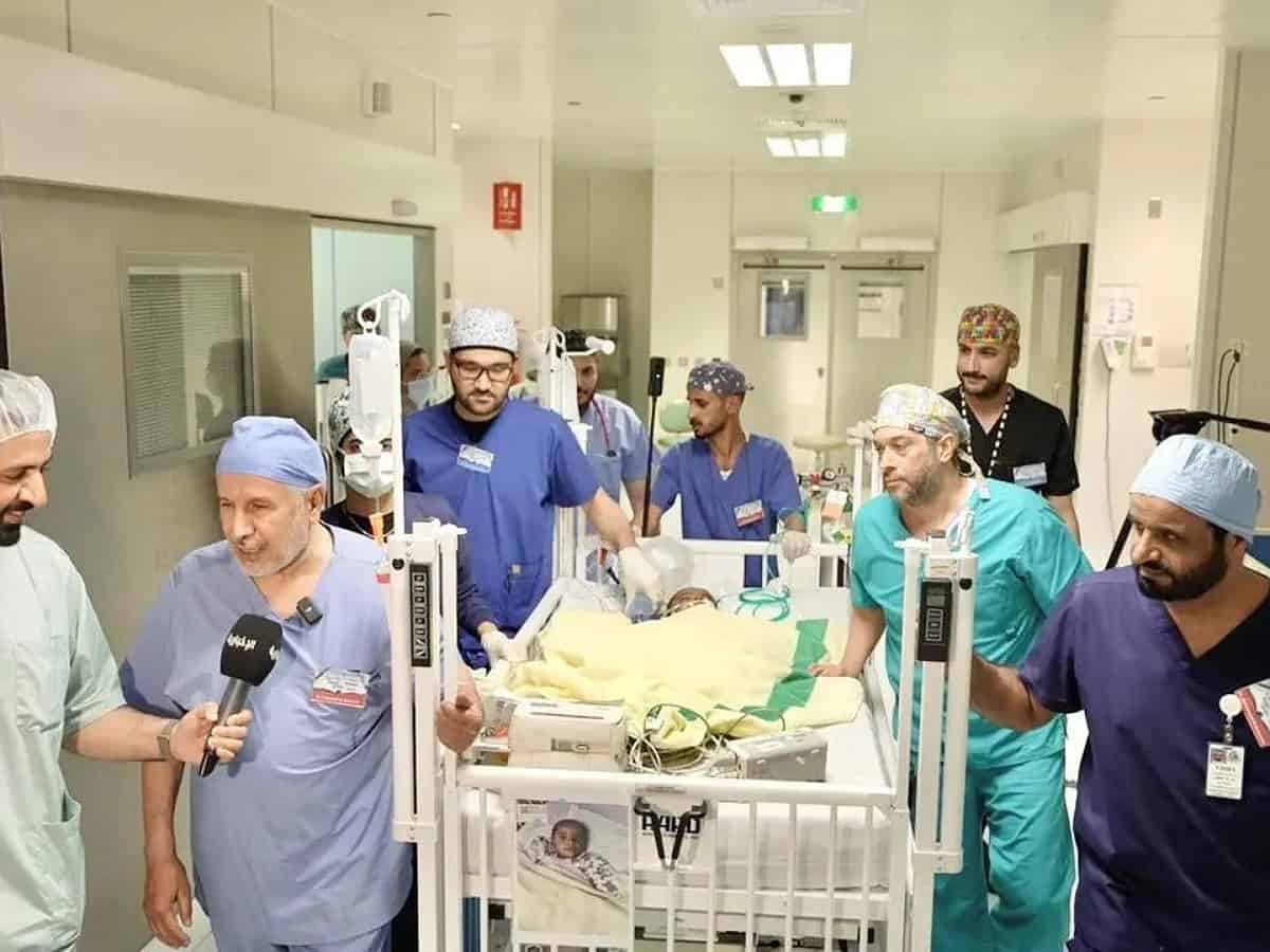 Saudi surgeons successfully separate Nigerian conjoined twins 'Hasna and Hasina'