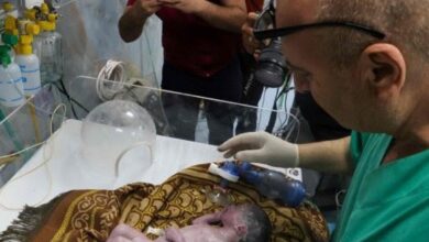 Gaza doctors save baby from mother's womb who was killed in Israeli strike