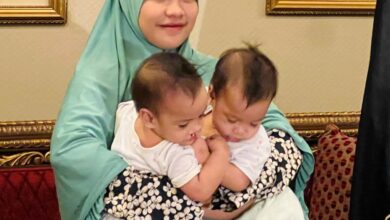 Saudi Arabia begins 7.5 hr surgery to separate conjoined Filipino twins