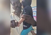 Child with black eye after alleged abuse by teacher.