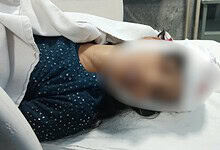 Injured person lying on hospital bed after falling light fixture incident in Hyderabad.